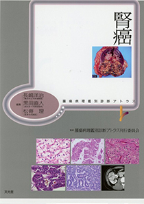 腎癌 腫瘍病理鑑別診断アトラス (文光堂)